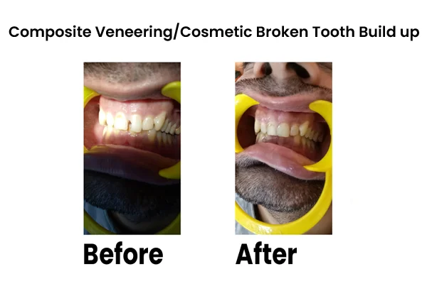 Dental Treatments