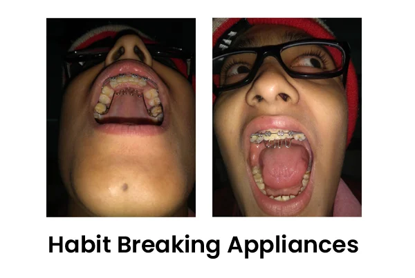 Dental Treatments