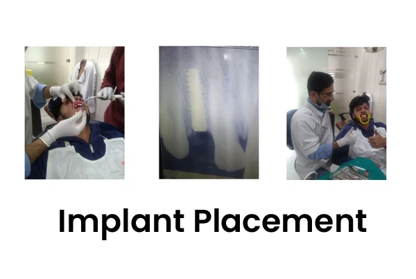 Dental Treatments