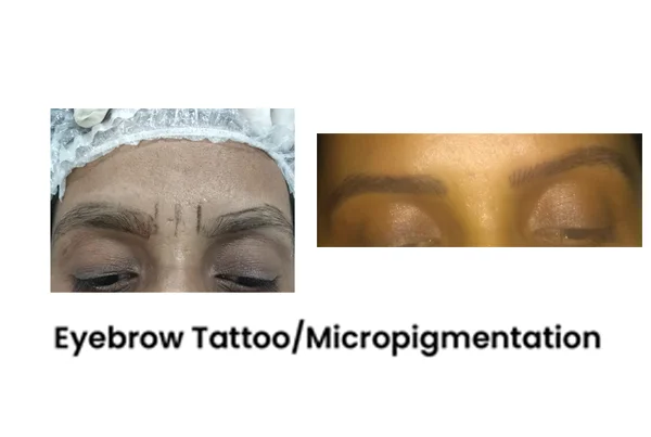Cosmetic Treatments