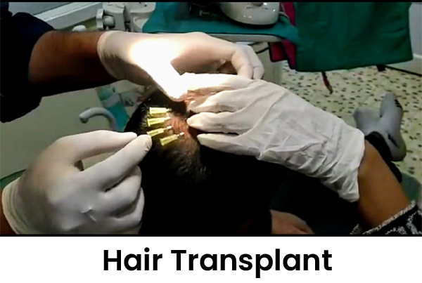 Cosmetic Treatments