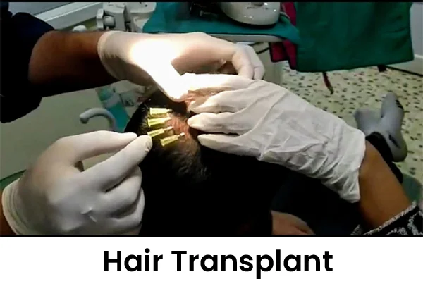 Cosmetic Treatments