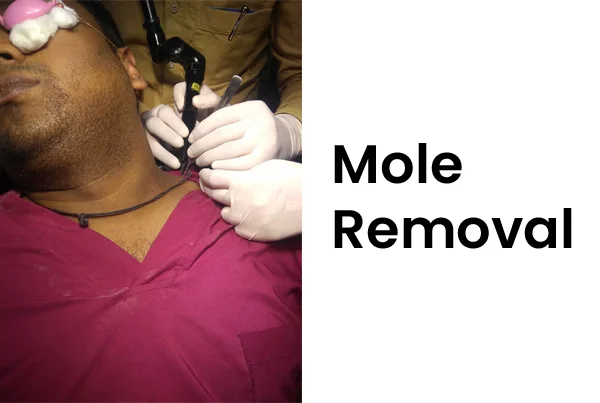 Cosmetic Treatments