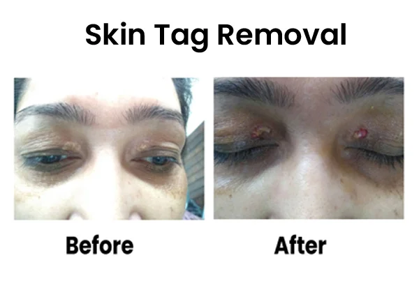 Cosmetic Treatments