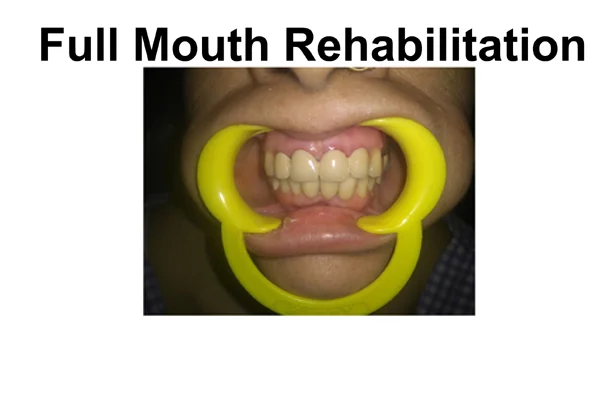 Dental Treatments
