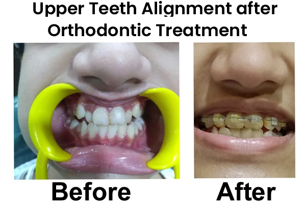 Dental Treatments