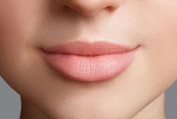 Lip Augmentation